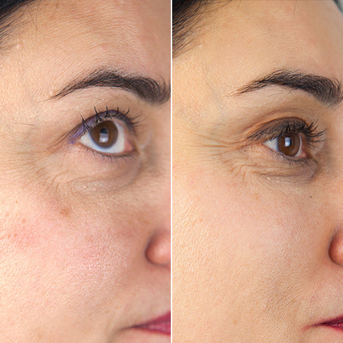 This Incredible New Dr. Dennis Gross Serum Faded My Dark Spot In Ju...