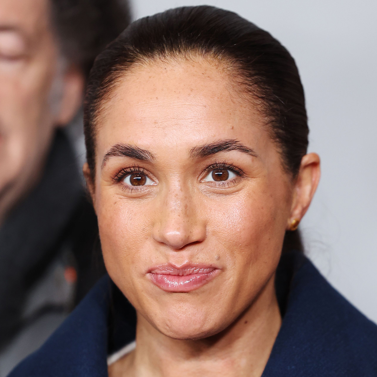 meghan markle plastic surgery Image 2