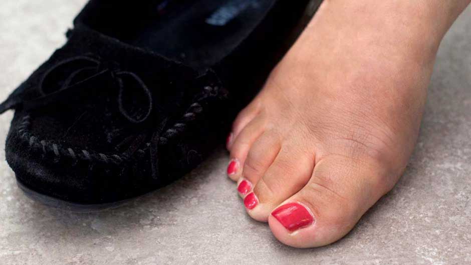 How To Remove Shoe Dye From Feet