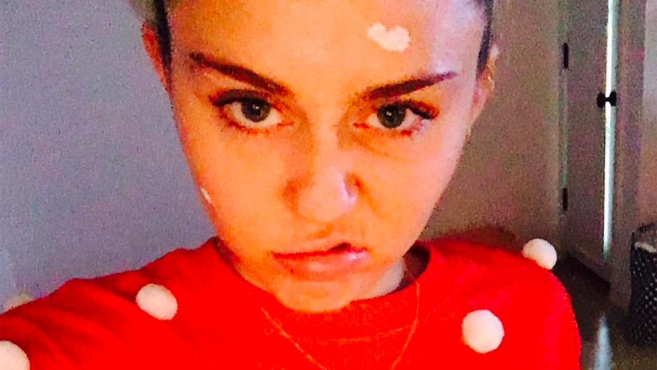 Celebrities who posted pics with zit cream SHEfinds