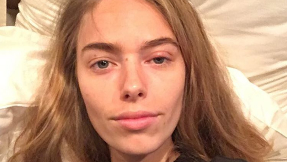 Model who got infection from makeup brushes SHEfinds