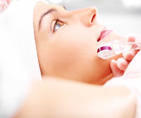 microneedling procedure