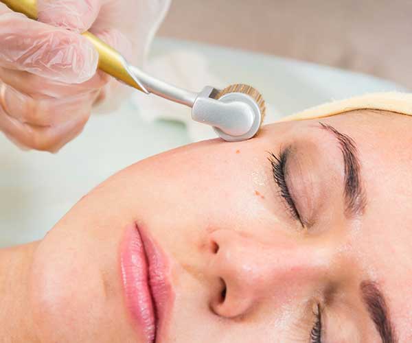 microneedling procedure dermatologist