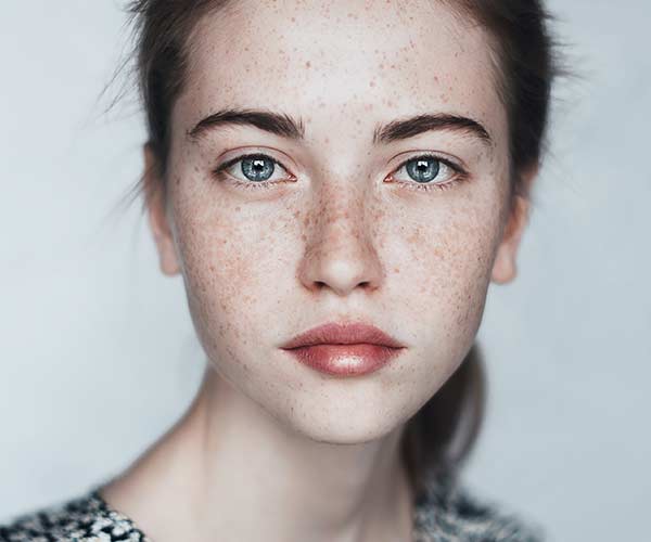 freckle skin health