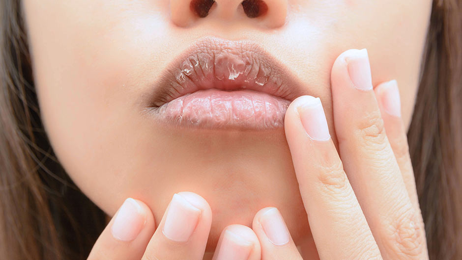 This Is The Worst Chapstick You Can Use, According To Dermatologists