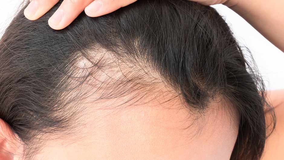 3 Drugstore Products For Thinning Hair That Dermatologists Swear By -  SHEfinds