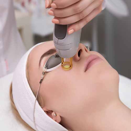 laser treatments