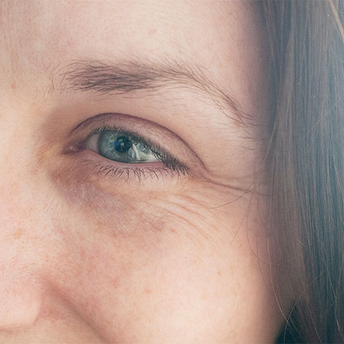 best anti aging serum for crows feet