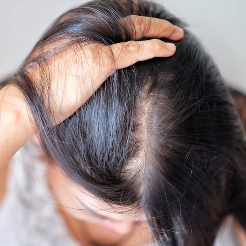 The Scary Reason Your Hair Keeps Falling Out, According To Experts