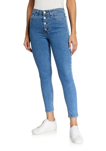 Ankle Skinny Jeans