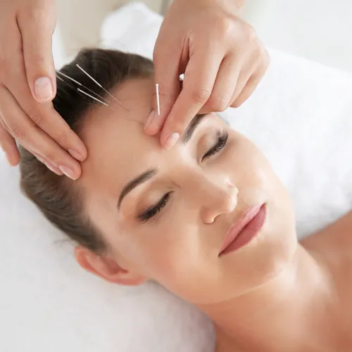 acupuncture