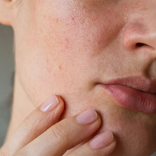 worst drugstore moisturizer anti aging skincare
