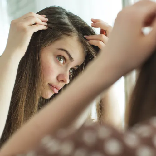 thinning hair