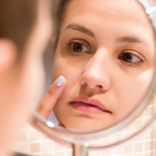 woman applying pimple cream