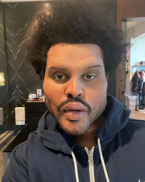 The Weeknd plastic surgery makeup