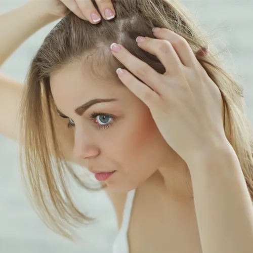 hair loss