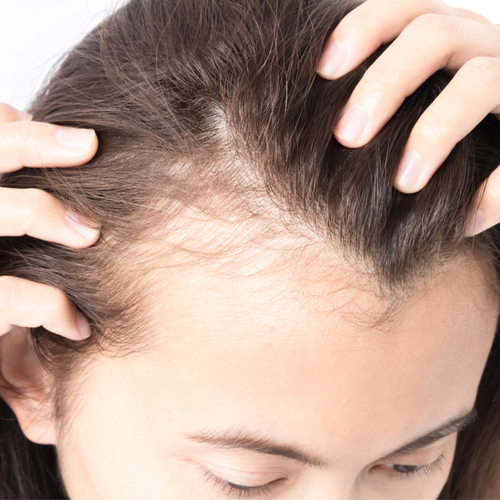 The Shampoo Dermatologists Swear By To Fix Hair Loss FOR GOOD SHEfinds