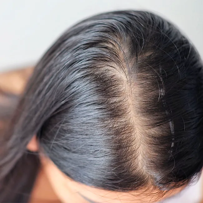 vitamin healthy hair