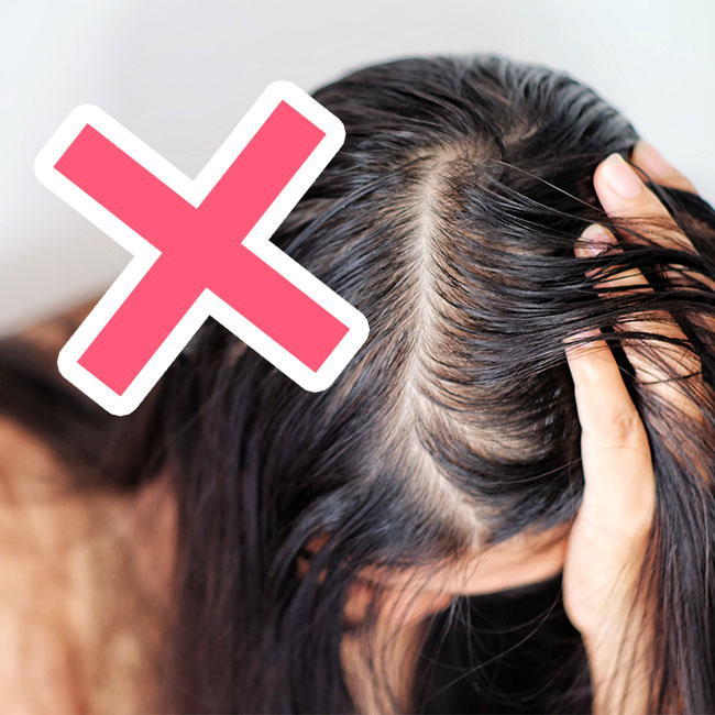 The Worst Mistake You Can Make If You Have Thinning Hair, According To A  Dermatologist - SHEfinds