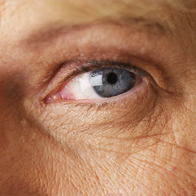 The Right Way To Get Rid Of Sunken Eyes, According To A Dermatologist