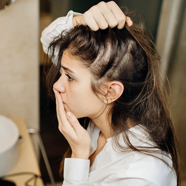 Woman with thinning hair and bald spots looking concerned
