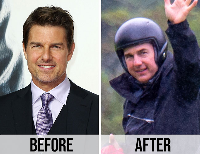 Tom Cruise before and after alleged cosmetic surgery