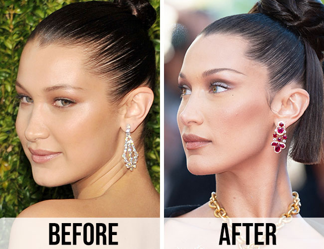 Bella Hadid Then Now See How Much Her Face Has Changed Over The
