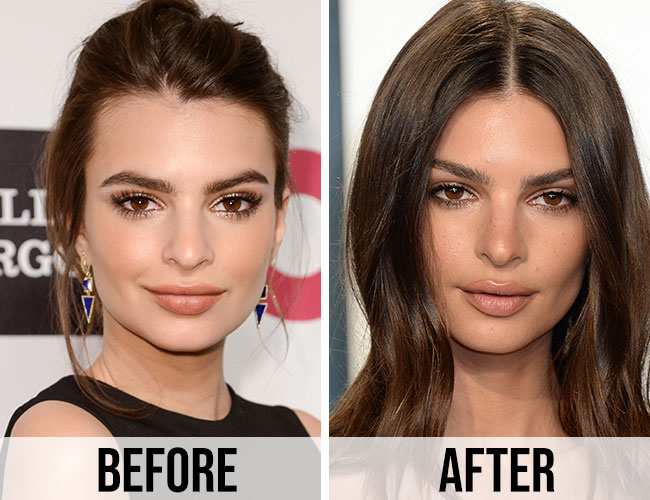 Emily Ratajkowski Even Look Like Herself Anymore—Her Face Has Changed SO Much - SHEfinds
