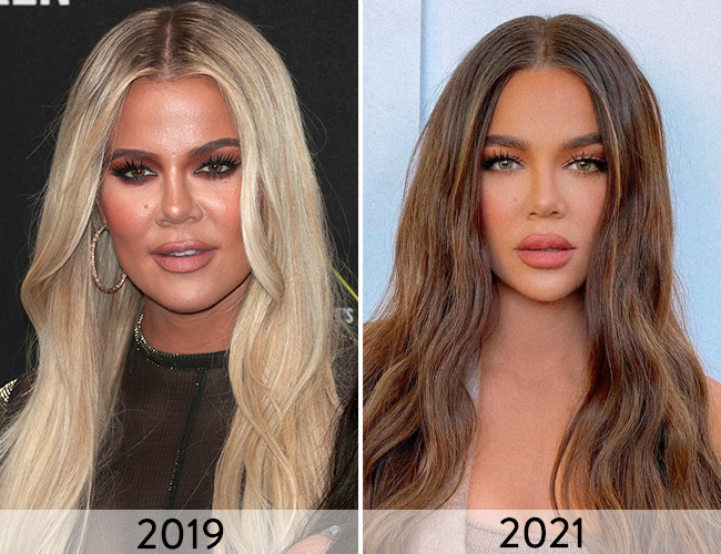 Khloé Kardashian's Gorgeous Before and After Photos