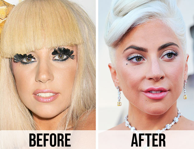 Did Lady Gaga Get A Nose Job