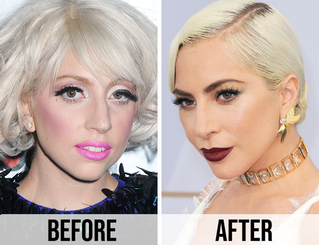 Lady gaga plastic surgery Before and after photos 