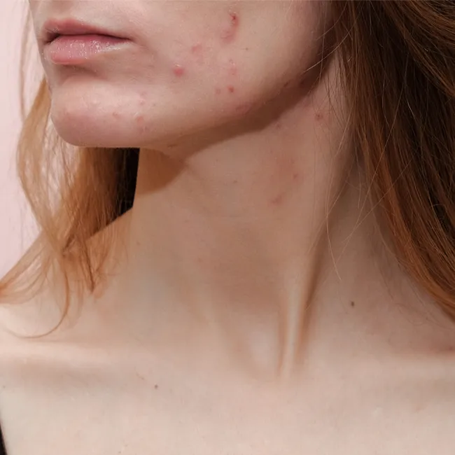 Image from SHEfinds