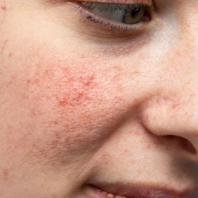 This Is The Worst Pore-Clogging Skincare Ingredient, According To Beauty Experts
