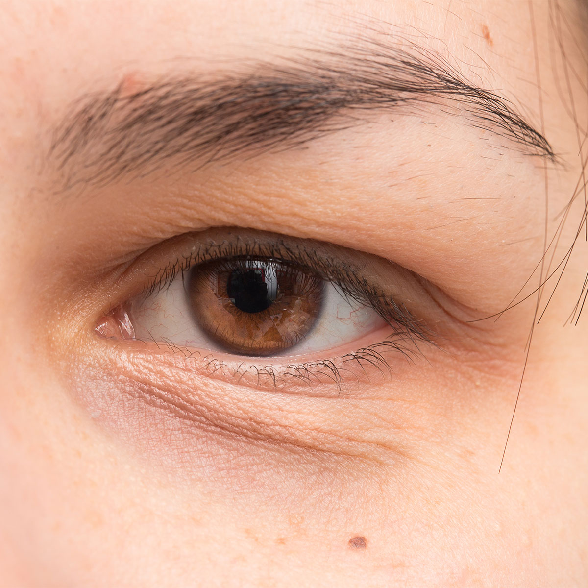 dark under-eye circles brown eyes close-up image
