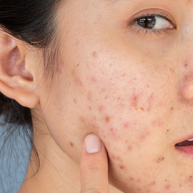 The One Skincare Habit That Makes Dark Spots So Much Worse