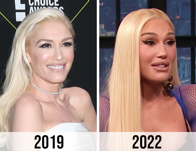 gwen stefani 2019 blonde hair natural face 2022 puffy face alleged cosmetic treatments plastic surgery