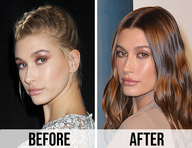 Hailey Bieber before and after