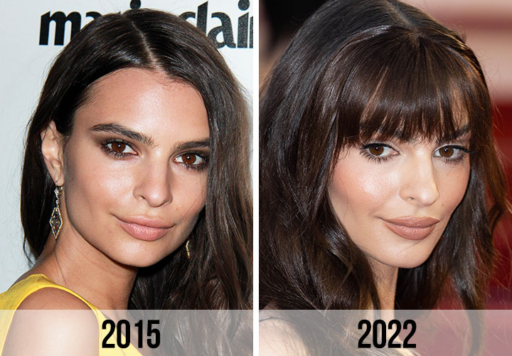 Emily Ratajkowski face side before and after