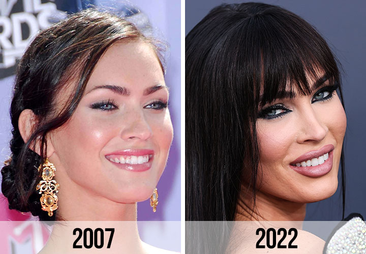 Megan Fox before and after pictures 2007 vs 2022