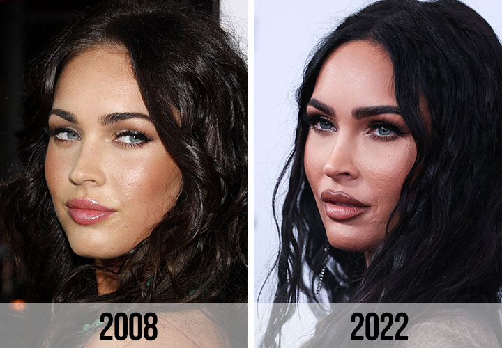 Megan Fox before and after pictures 2008 vs 2022