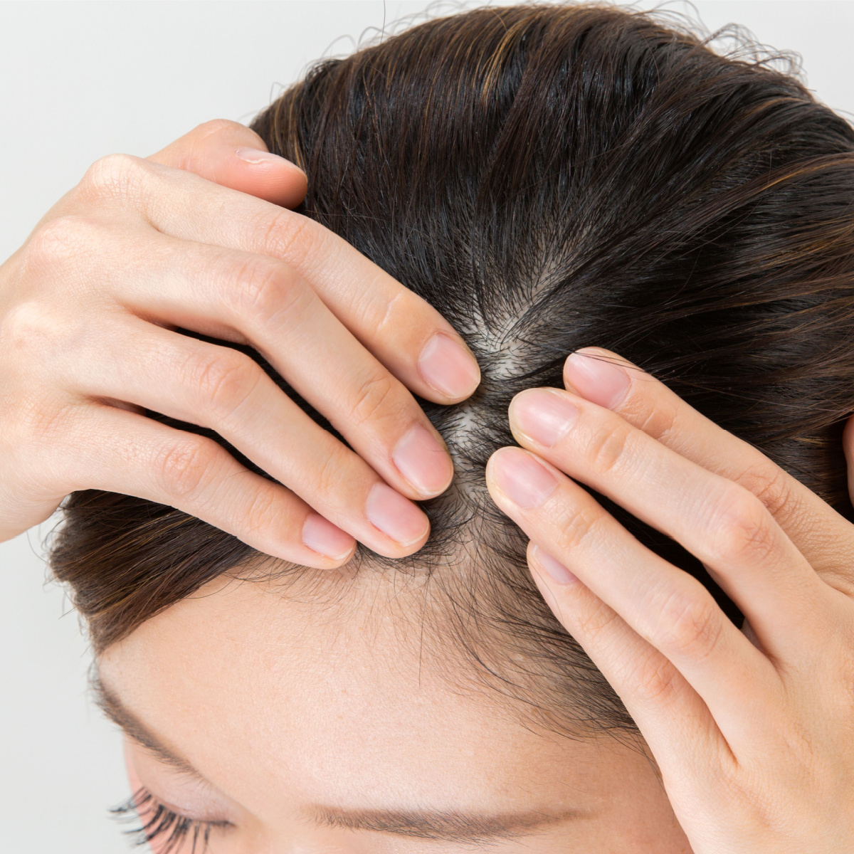 woman touching thinning hair hair loss scalp brown hair hands