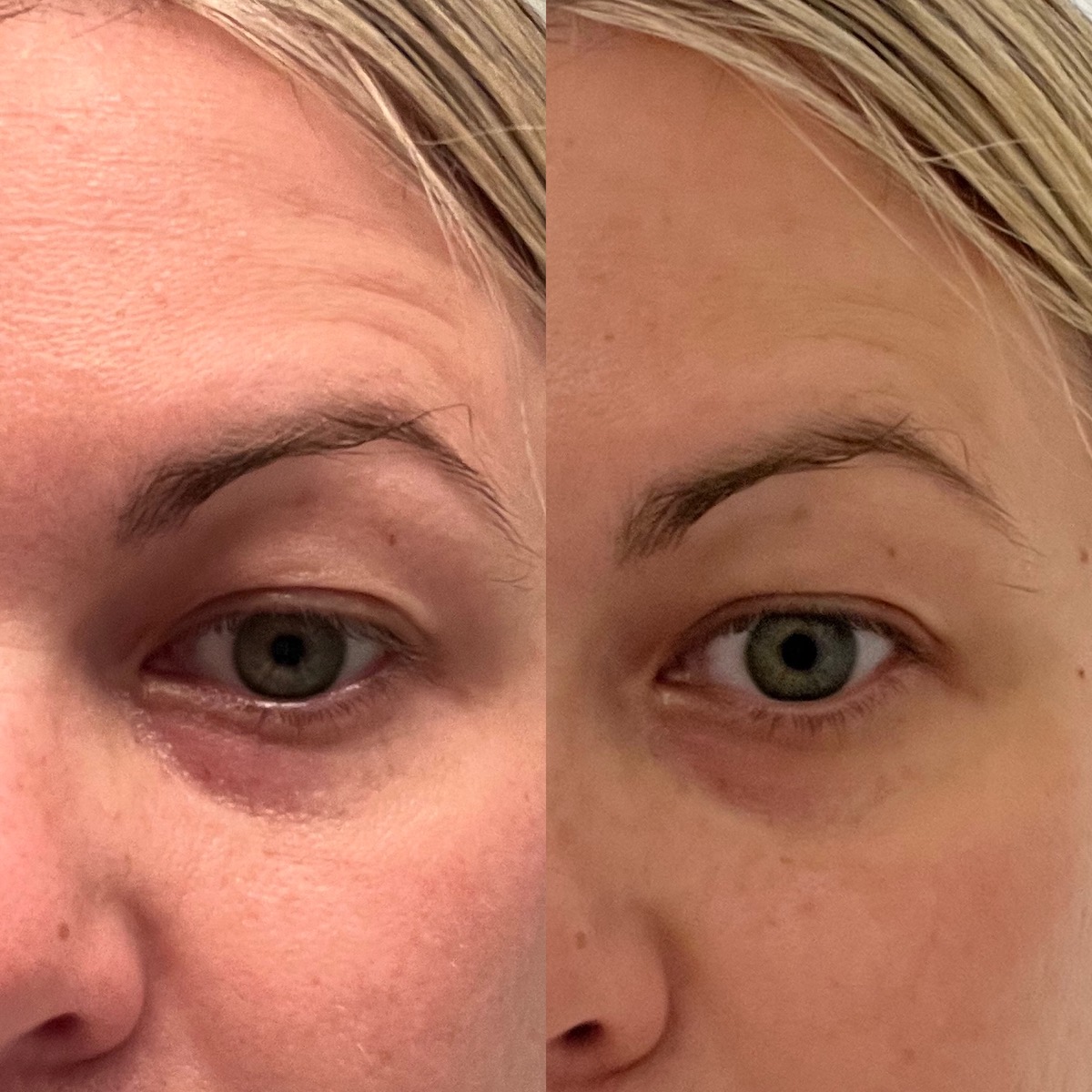 I Tried MAELYS Wow-It Eye Cream On My Dark Circles–Here Are The Results -  SHEfinds