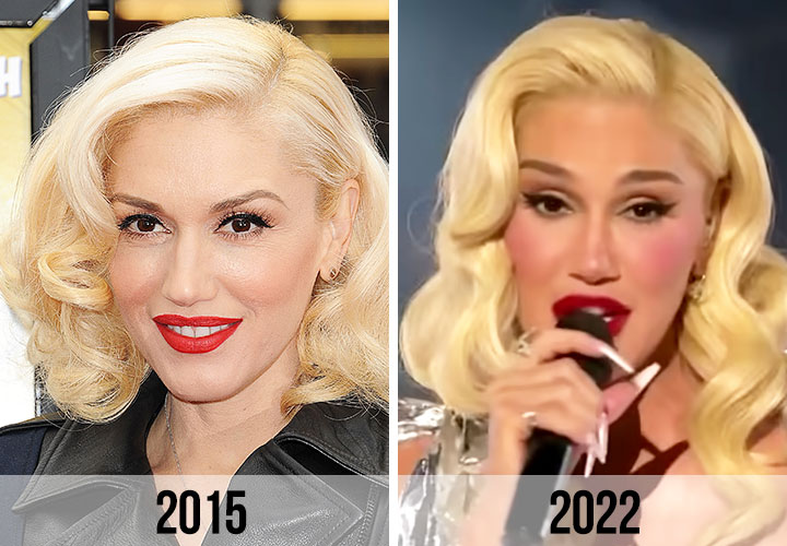 Gwen Stefani before and after 2015 vs 2022