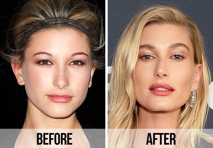 Hailey Bieber before and after pictures