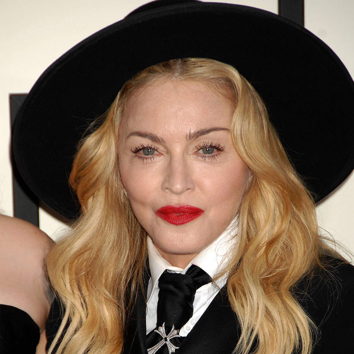 Madonna Looks 'Unrecognizable' Now—A Plastic Surgeon Weighs In: 'At Least  12 Cosmetic Procedures