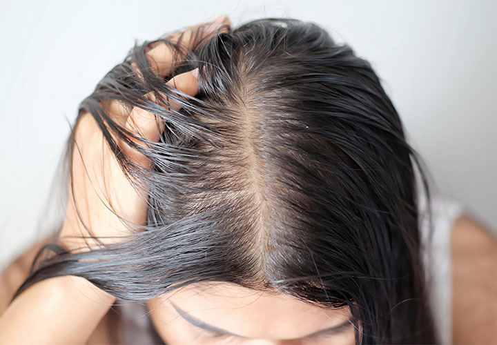 thinning hair on the scalp