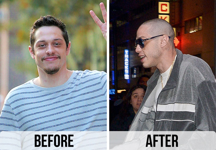 Pete Davidson shaved head before and after