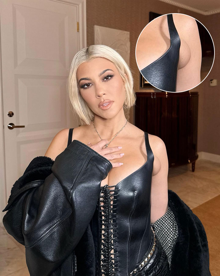 Kourtney Kardashian lump on arm Instagram picture