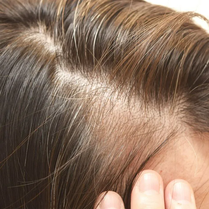 Close-up of a woman's scalp showing grey hairs.