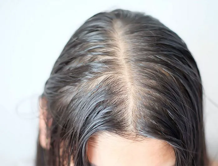 Sparse black hair on a scalp.